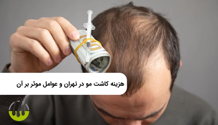 هزینه کاشت مو در تهران و عوامل موثر بر آن