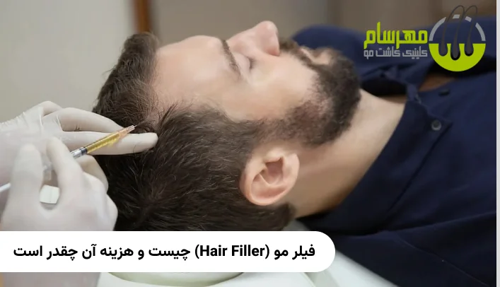 فیلر مو (Hair Filler) چیست و هزینه آن چقدر است