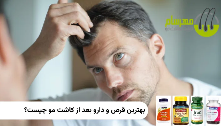 بهترین قرص و دارو بعد از کاشت مو چیست؟